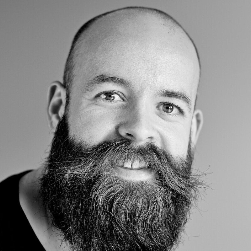  Hair Transplants – Are they truly worth the hype? 